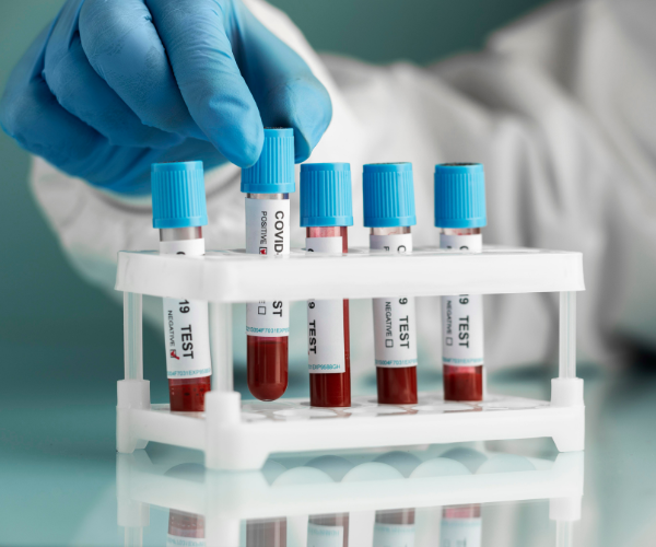 Blood Sample Collection