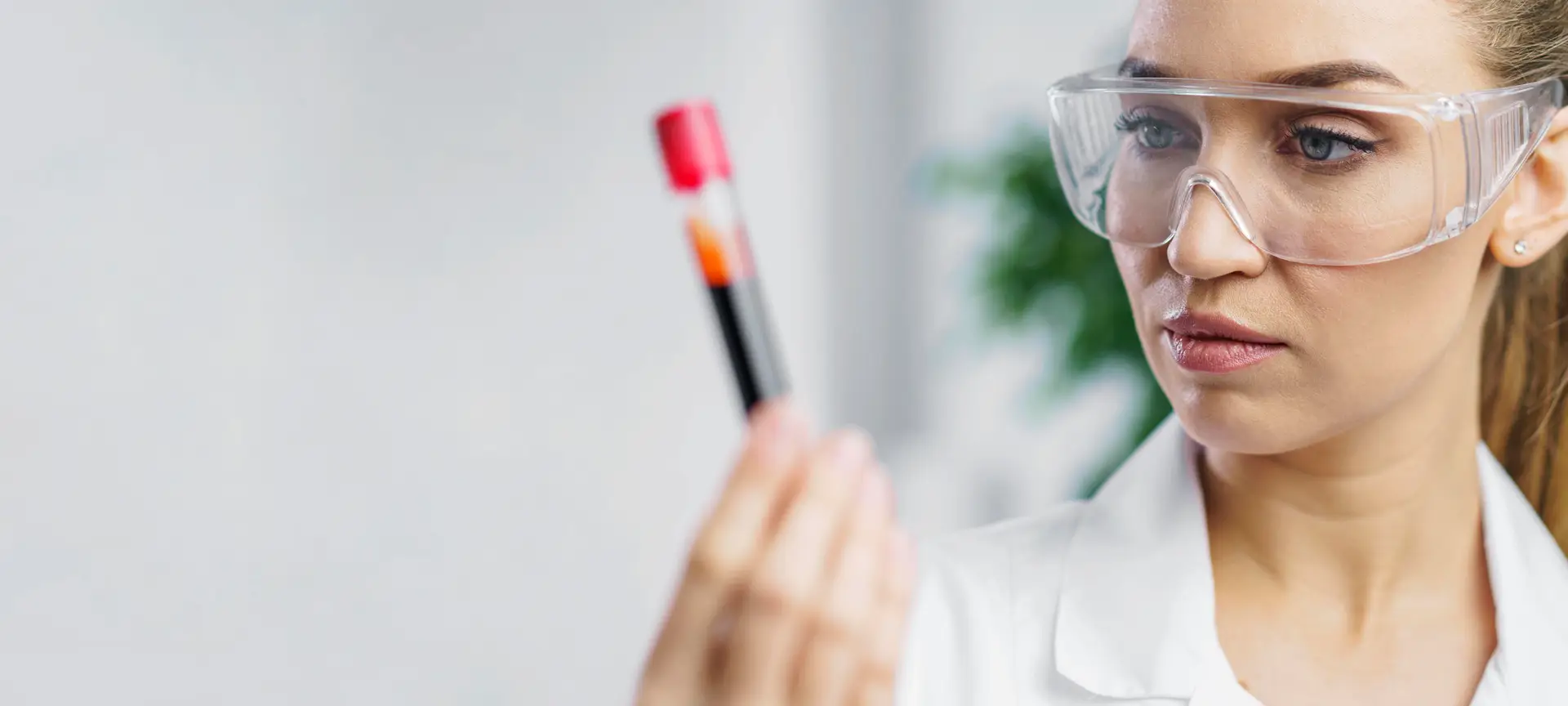 blood test