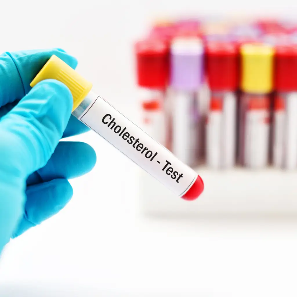 blood test at home